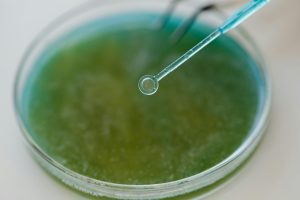 Produtos de limpeza não são suficientes para conter a replicação de alguns tipos de bactérias, por isso a fiscalização dos ambientes de produção e envase é necessária. Foto: Pexels.